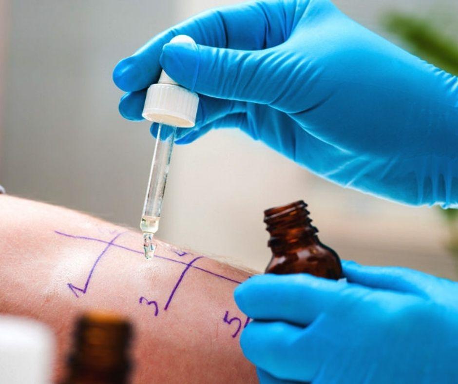 Allergy Testing​