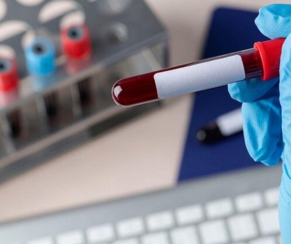 Blood Group Test​