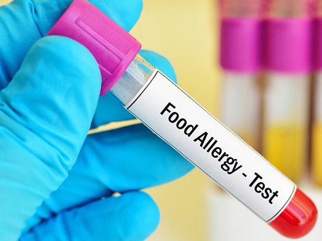 Allergy Vegetarian + Nonvegetarian Panel shree laboratory jamnagar