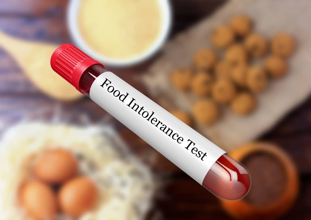Food Intolerance Test shree laboratory jamnagar