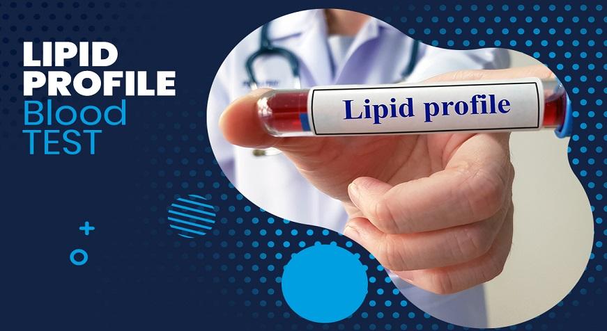 Lipid Profile blood test shree laboratory jamnagar