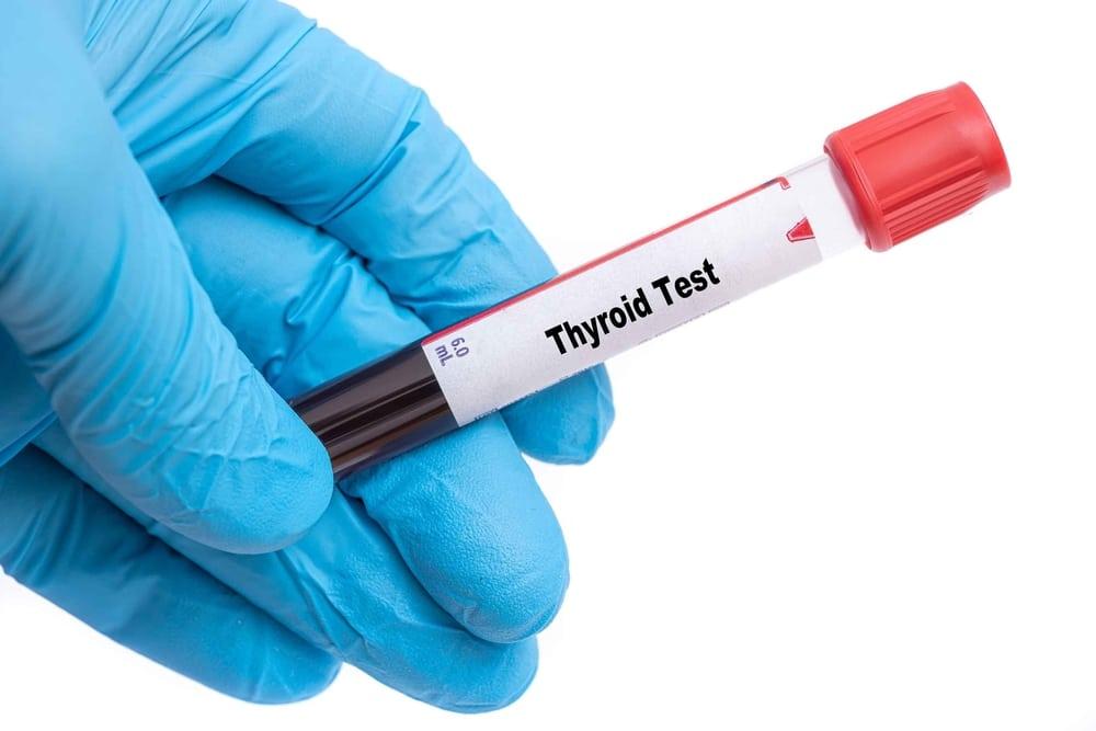 Thyroid,Test,Medical,Check,Up,Test,Tube,With,Biological,Sample