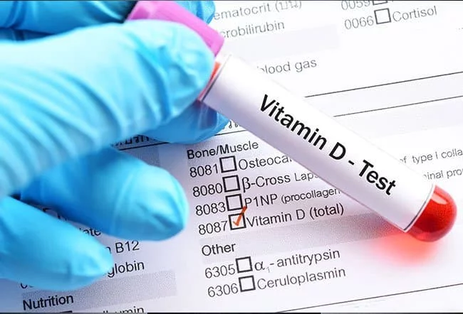 Vitamin D Blood Test shree laboratory jamnagar