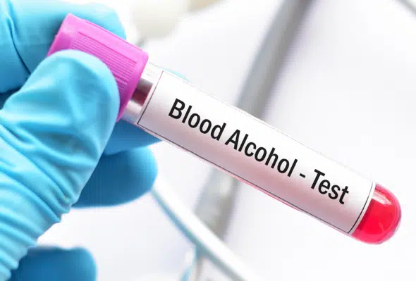 blood alchohol test shreelab jamnagar