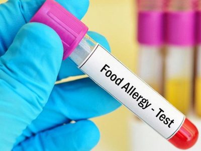 Allergy Vegetarian + Nonvegetarian Panel shree laboratory jamnagar