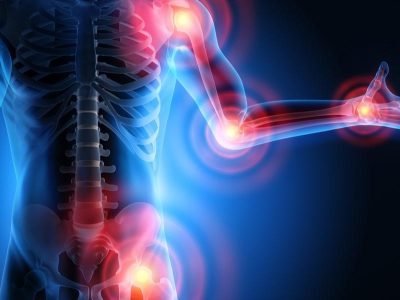 Arthritis shree laboratory jamnagar