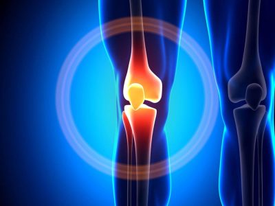 Bone and Joint shree laboratory jamnagar