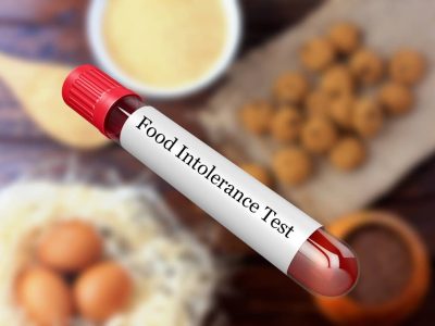 Food Intolerance Test shree laboratory jamnagar