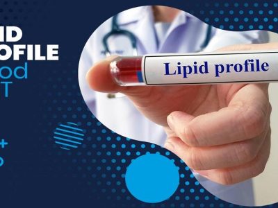 Lipid Profile blood test shree laboratory jamnagar