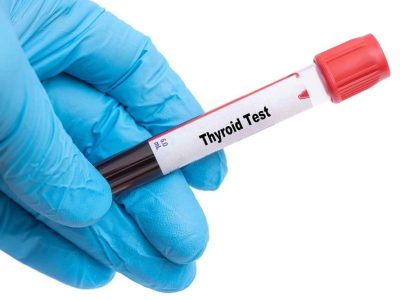 Thyroid,Test,Medical,Check,Up,Test,Tube,With,Biological,Sample