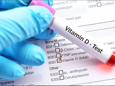 Vitamin D Blood Test shree laboratory jamnagar