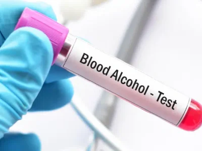 blood alchohol test shreelab jamnagar